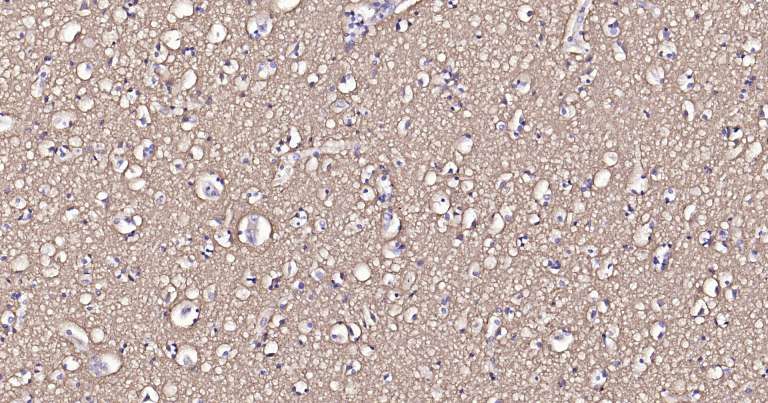 钠钾ATP酶蛋白a1即用型免疫组化试剂盒-IHC0259